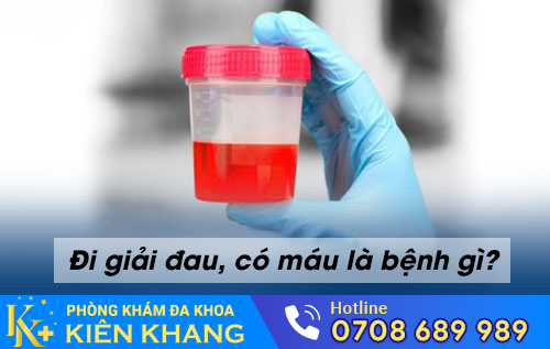 Đi giải đau, có máu