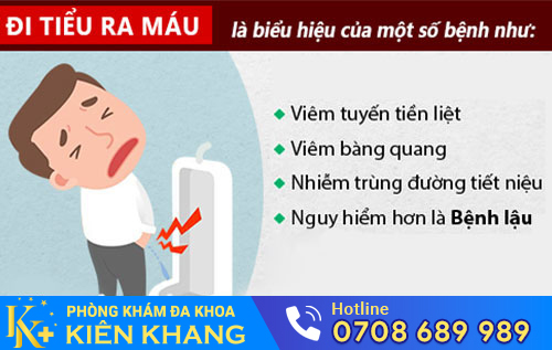 Tiểu có lẫn máu là dấu hiệu nhiều bệnh nguy hiểm