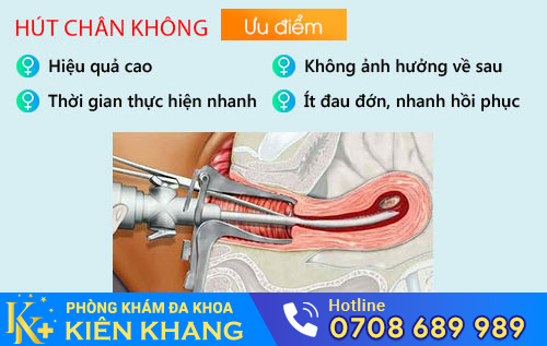 Hút thai chân không