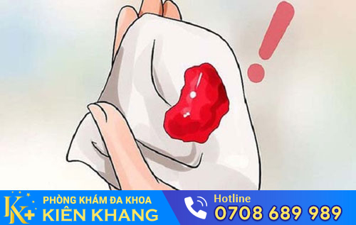 Quan hệ ra máu