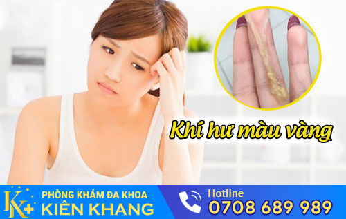 Khí hư màu vàng