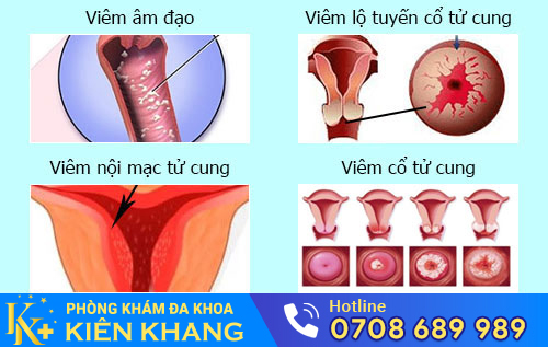 Nguyên nhân chậm kinh ra máu