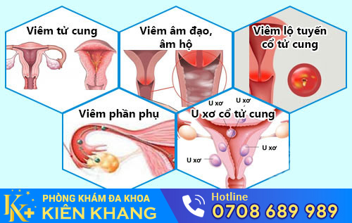 Nguyên nhân khí hư có màu xanh