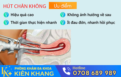 Bỏ thai 2 tháng bằng cách hút thai