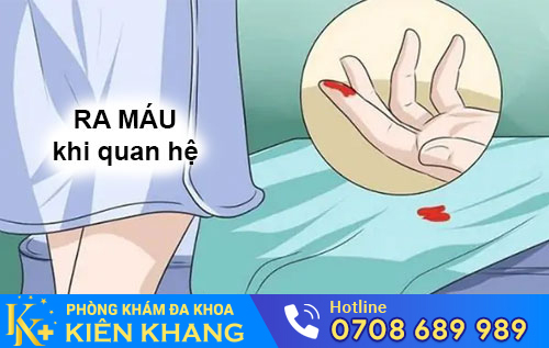 Ra máu khi quan hệ