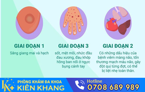Biểu hiện bệnh giang mai