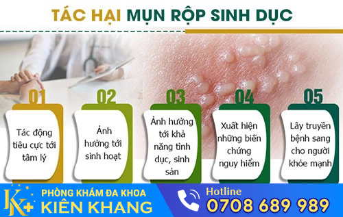 Biểu hiện của bệnh mụn rộp sinh dục