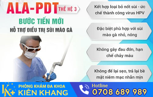 Các phương pháp điều trị sùi mào gà hiệu quả tại Phòng Khám Đa Khoa Kiên Khang