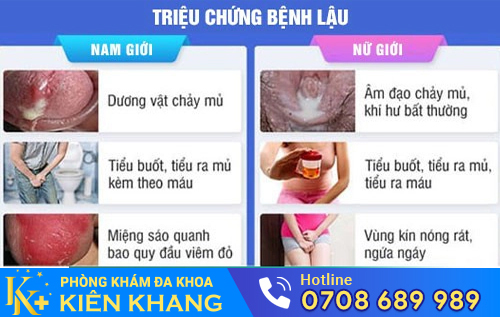 Bệnh lậu cần được điều trị càng sớm càng tốt