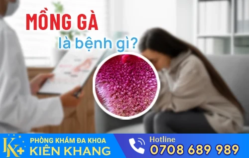 benh mong ga la benh gi