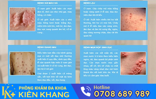 Một số bệnh xã hội thường gặp