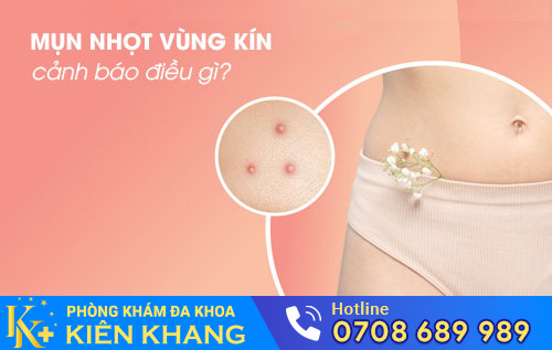 Mụn nhọt vùng kín