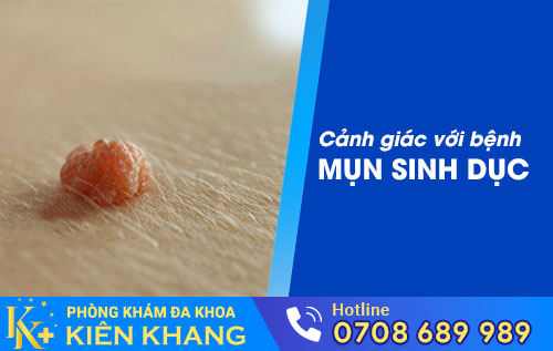 Cảnh giác với bệnh mụn sinh dục