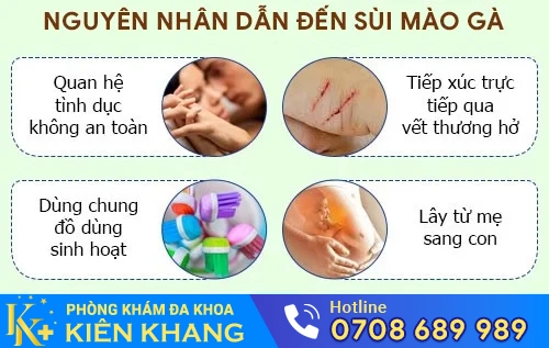 nguyen nhan sui mao ga