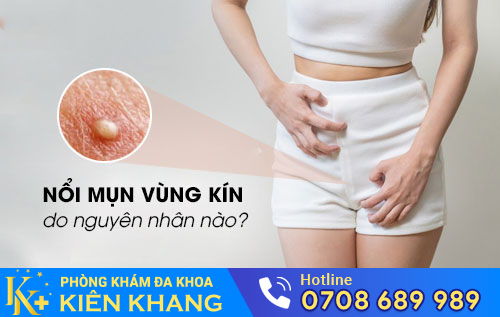 Nổi mụn vùng kín