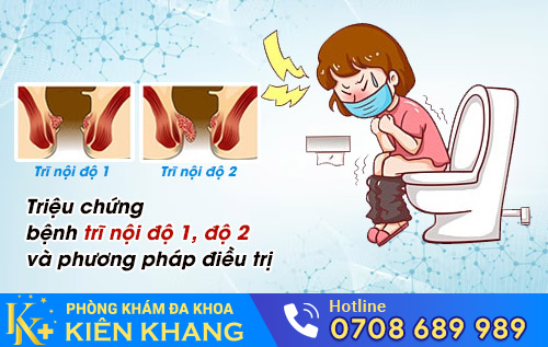 Triệu chứng bệnh trĩ nội độ 1 độ 2