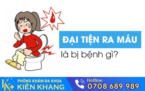 Đại tiện ra máu