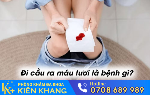 Đi cầu ra máu tươi