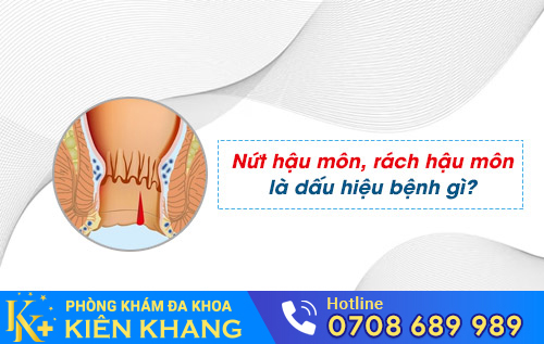 Nứt hậu môn, rách hậu môn