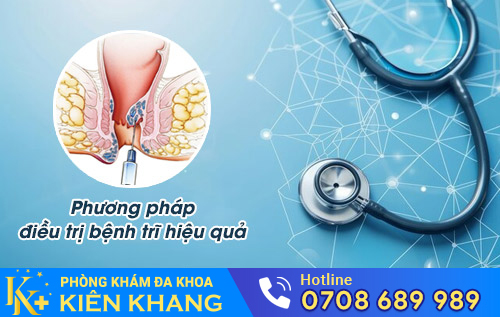 Phương pháp điều trị bệnh trĩ hiệu quả