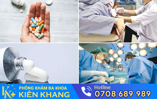 Phương pháp điều trị nóng rát hậu môn
