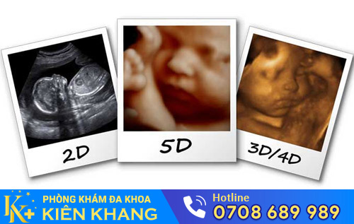 Siêu âm hình thái học