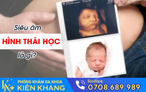 Siêu âm hình thái học